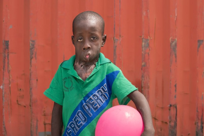 Saidou awaiting admissions on the dock.